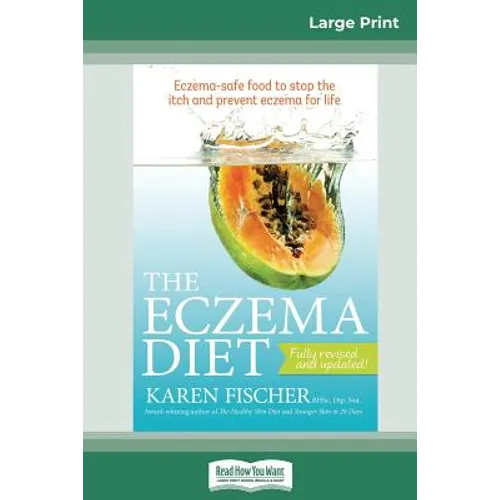 The Eczema Diet (2nd edition): Eczema-Safe Food to Stop The Itch and Prevent Eczema for Life (16pt Large Print Edition) - Paperback