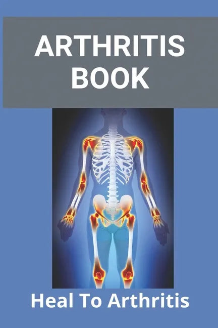 Arthritis Book: Heal To Arthritis: Rheumatoid Arthritis Treatment - Paperback