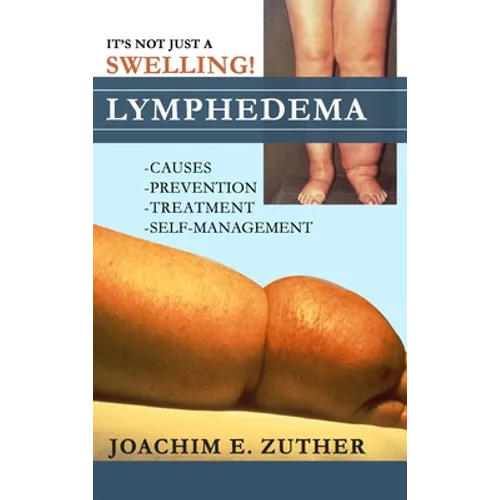 It's Not Just a Swelling! Lymphedema: Causes, Prevention, Treatment, Self-Management - Hardcover