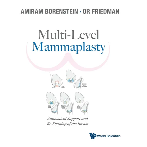 Multi-Level Mammaplasty: Anatomical Support and Re-Shaping of the Breast - Hardcover