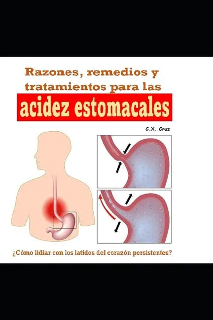 Razones, remedios y tratamientos para las acidez estomacales: ¿Cómo lidiar con los latidos del corazón persistentes? - Paperback