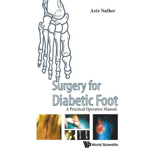 Surgery for Diabetic Foot: A Practical Operative Manual - Hardcover