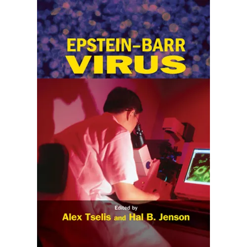 Epstein-Barr Virus - Paperback