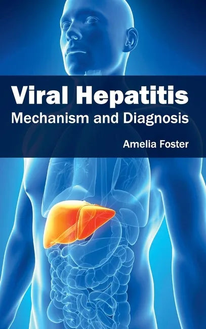 Viral Hepatitis: Mechanism and Diagnosis - Hardcover