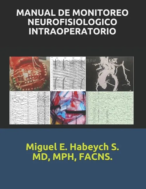 Manual de Monitoreo Neurofisiológico Intraoperatorio. - Paperback