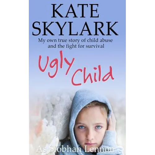 Ugly Child: My Own True Story of Child Abuse and the Fight for Survival - Paperback