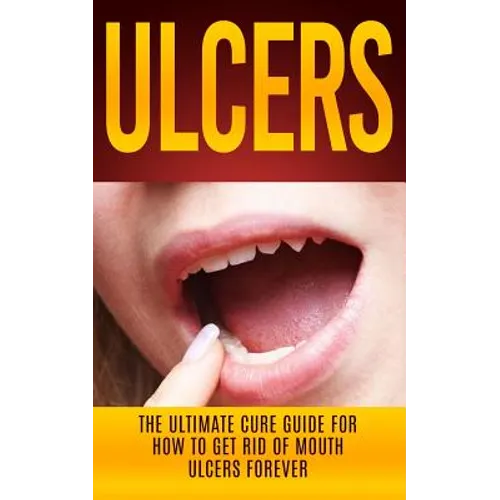 Ulcers: The Ultimate Cure Guide for How to Get Rid of Mouth Ulcers Instantly - Paperback