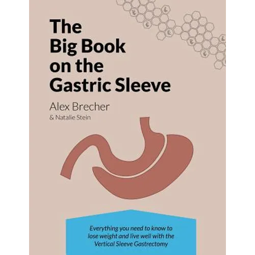 The Big Book on the Gastric Sleeve: Everything You Need to Know to Lose Weight and Live Well with the Vertical Sleeve Gastrectomy - Paperback