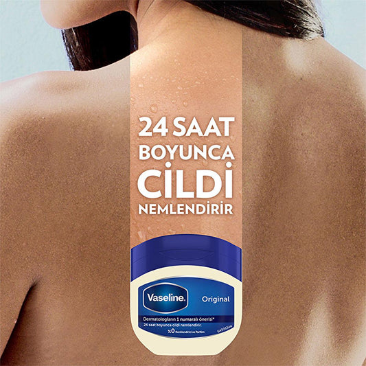 Vaseline Original Moisturizing Jelly - 24 Hour Hydration for Dry Skin, Hypoallergenic & Dermatologist-Recommended