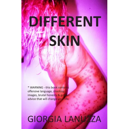 Different Skin - Paperback