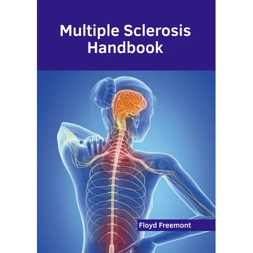 Multiple Sclerosis Handbook - Hardcover