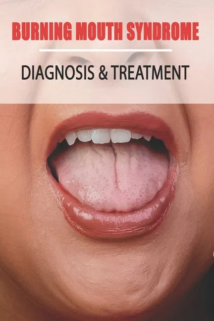 Burning Mouth Syndrome: Diagnosis & Treatment: Burning Mouth Syndrome Guide - Paperback