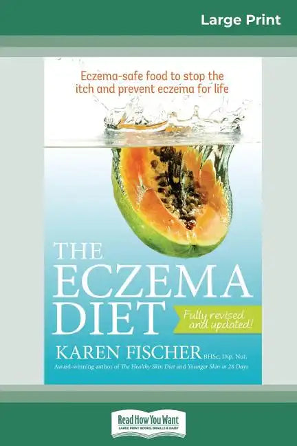 The Eczema Diet (2nd edition): Eczema-Safe Food to Stop The Itch and Prevent Eczema for Life (16pt Large Print Edition) - Paperback