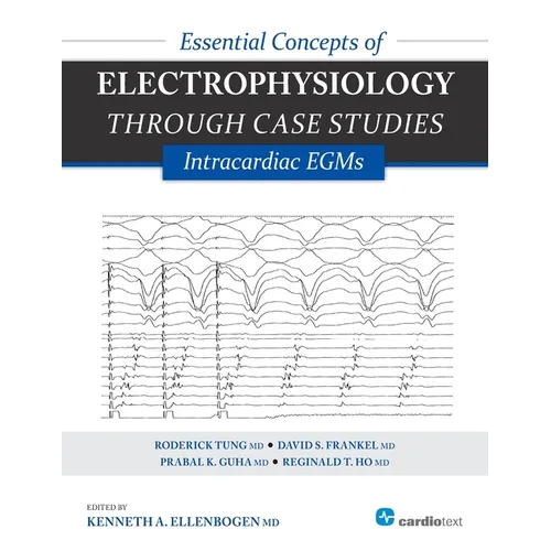 Essential Concepts of Electrophysiology Through Case Studies: Intracardiac EGMs: Intracardiac EGMs - Paperback