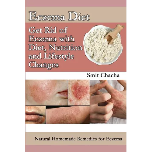 Eczema Diet - Get Rid of Eczema with Diet, Nutrition and Lifestyle Changes: Natural Homemade Remedies for Eczema - Paperback
