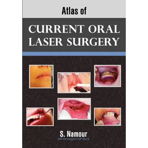Atlas of Current Oral Laser Surgery - Paperback