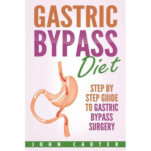 Gastric Bypass Diet: Step By Step Guide to Gastric Bypass Surgery - Paperback