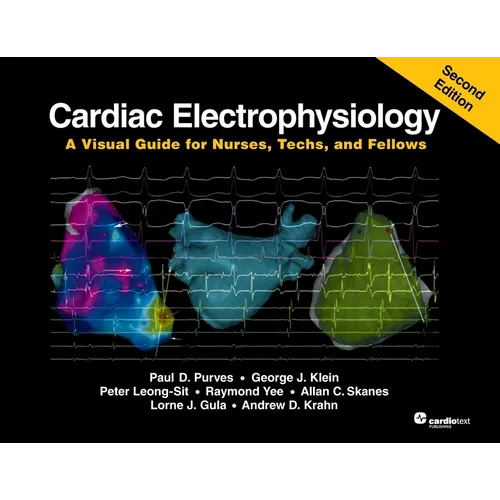 Cardiac Electrophysiology: A Visual Guide for Nurses, Techs, and Fellows, Second Edition - Paperback