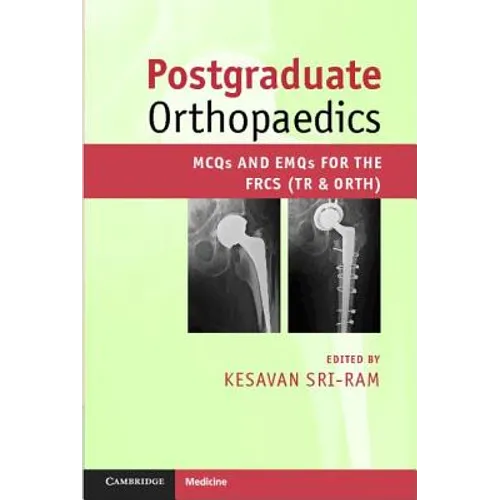 Postgraduate Orthopaedics - Paperback