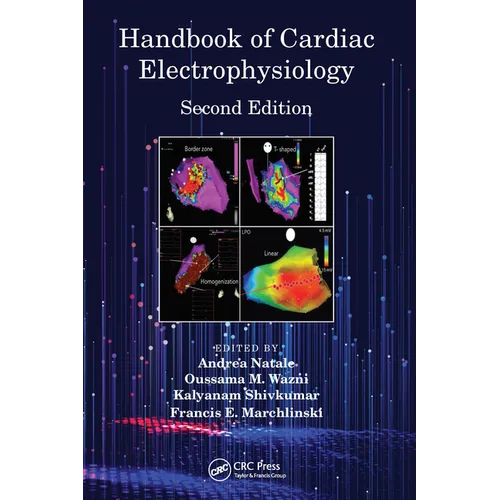 Handbook of Cardiac Electrophysiology - Paperback