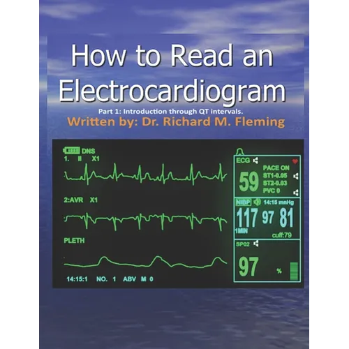How to Read an Electrocardiogram. - Paperback