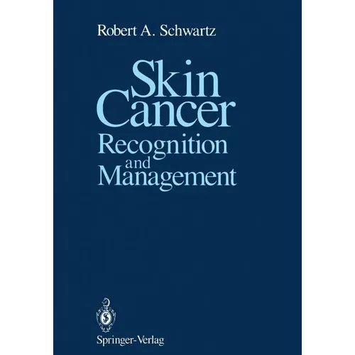 Skin Cancer: Recognition and Management - Paperback