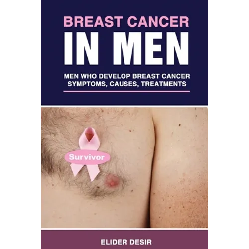 Breast Cancer in Men: Men Who Develop Breast Cancer: Symptoms, Causes and Treatments - Paperback