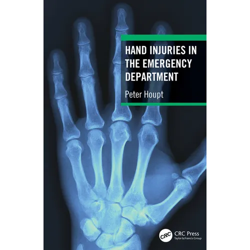 Hand Injuries in the Emergency Department - Paperback