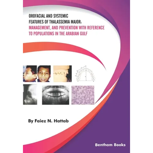 Orofacial and Systemic Features of Thalassemia Major: Management, and Prevention with Reference to Populations in the Arabian Gulf - Paperback