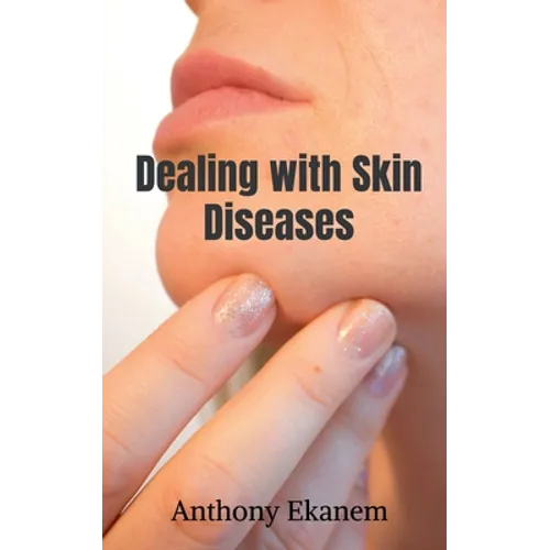 Dealing with Skin Diseases - Paperback