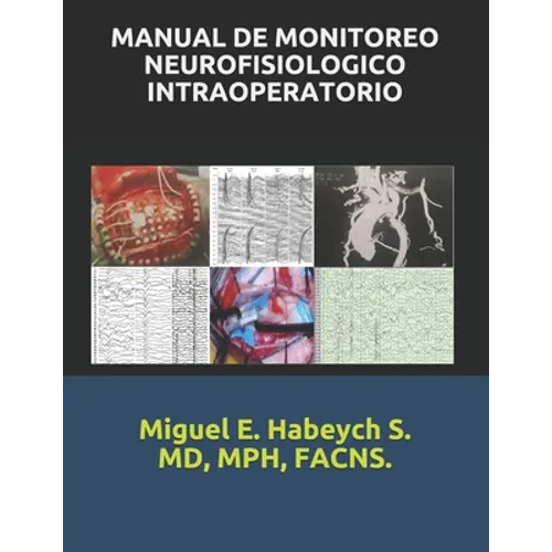 Manual de Monitoreo Neurofisiológico Intraoperatorio. - Paperback