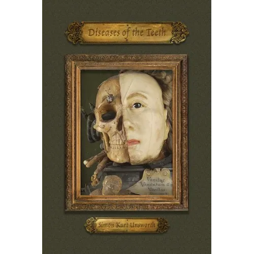 Diseases of the Teeth - Paperback