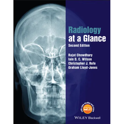 Radiology at a Glance - Paperback