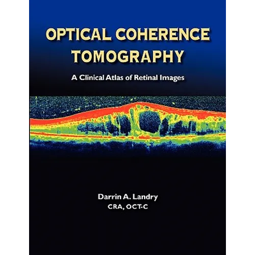 Optical Coherence Tomography a Clinical Atlas of Retinal Images - Paperback