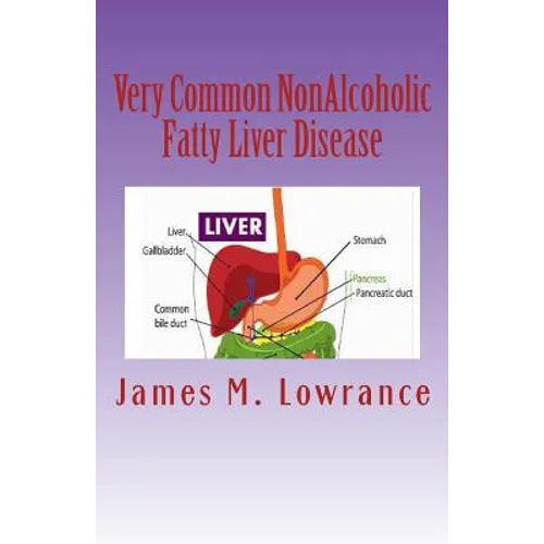 Very Common NonAlcoholic Fatty Liver Disease: How To Know if You Have Hepatic Steatosis - Paperback