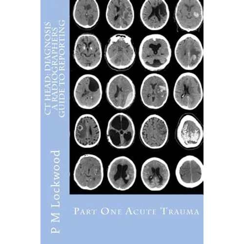 CT Head: DIAGNOSIS A Radiographers Guide To Reporting Part 1 Acute Trauma: Part One Acute Trauma - Paperback