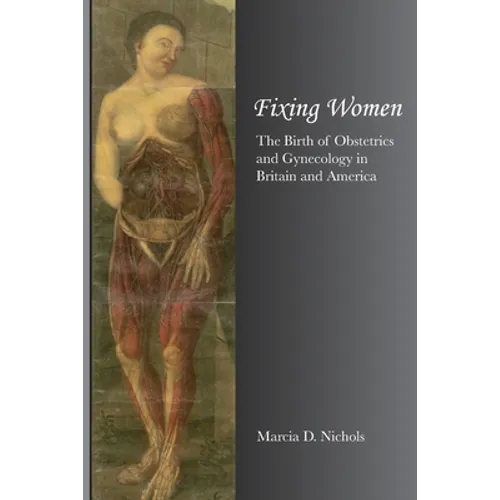 Fixing Women - Paperback