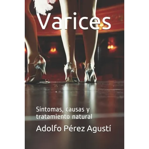 Varices: Síntomas, causas y tratamiento natural - Paperback