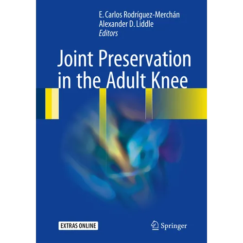 Joint Preservation in the Adult Knee - Hardcover