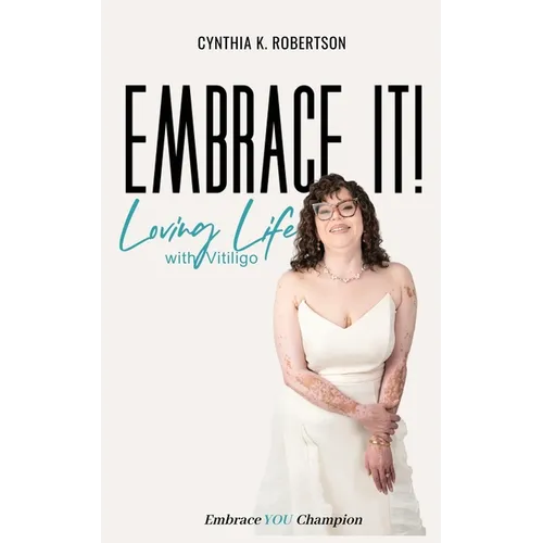 Embrace It: Loving Life with Vitiligo - Paperback