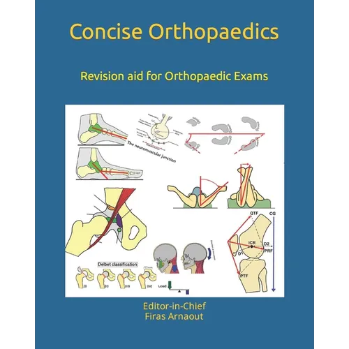 Concise Orthopaedic Notes: Revision aid for FRCS, EBOT , SICOT and Board Examinations - Paperback
