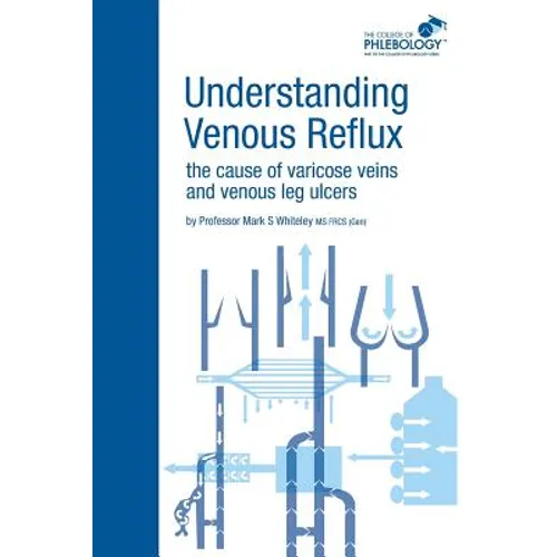 Understanding Venous Reflux the Cause of Varicose Veins and Venous Leg Ulcers: Varicose veins and venous leg ulcers - Paperback