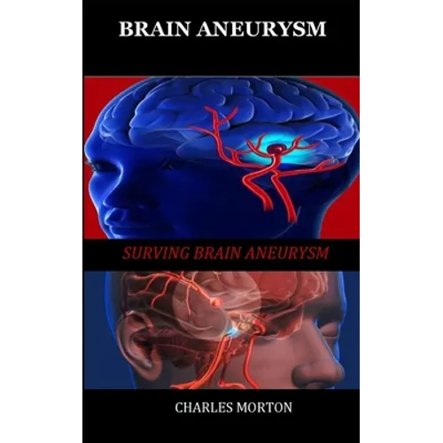 Brain Aneurysm: Surviving Aneurysm - Paperback