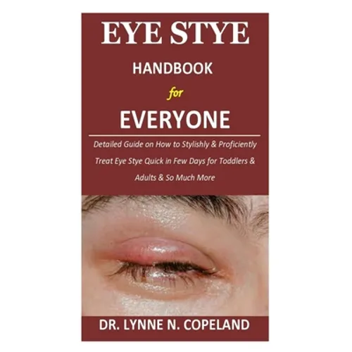 Eye Stye Handbook for Everyone: Detailed Guide on How to Stylishly & Proficiently Treat Eye Stye Quick in Few Days for Toddlers & Adults & So Much Mor - Paperback