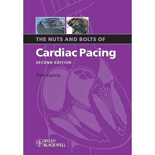 Nuts Bolts Cardiac Pacing 2e - Paperback
