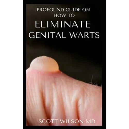 Profound Guide to Eliminate Genital Warts: The Ultimate Guide To Eliminate Genital Warts - Paperback