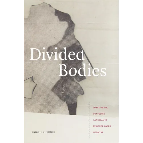 Divided Bodies: Lyme Disease, Contested Illness, and Evidence-Based Medicine - Paperback