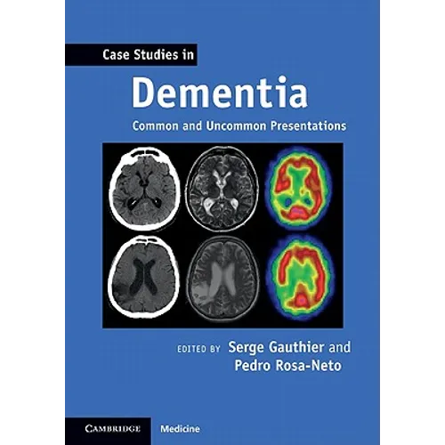 Case Studies in Dementia: Volume 1: Common and Uncommon Presentations - Paperback