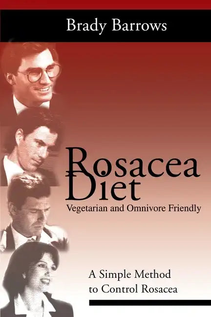 Rosacea Diet: A Simple Method to Control Rosacea - Paperback
