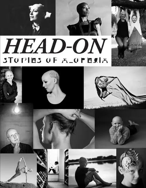 Head-On, Stories of Alopecia - Paperback